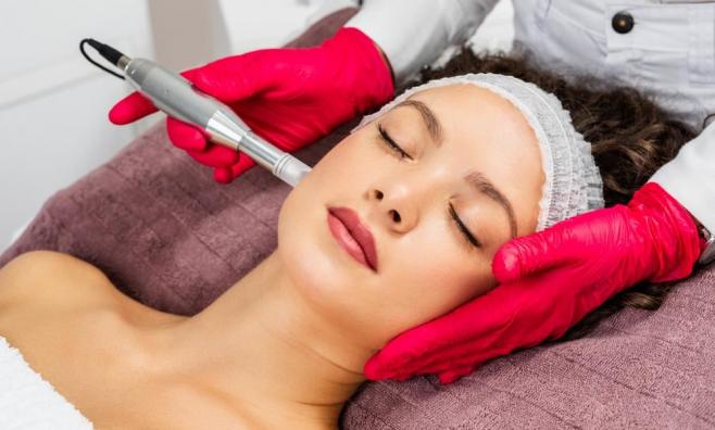 Microneedling im Gesicht